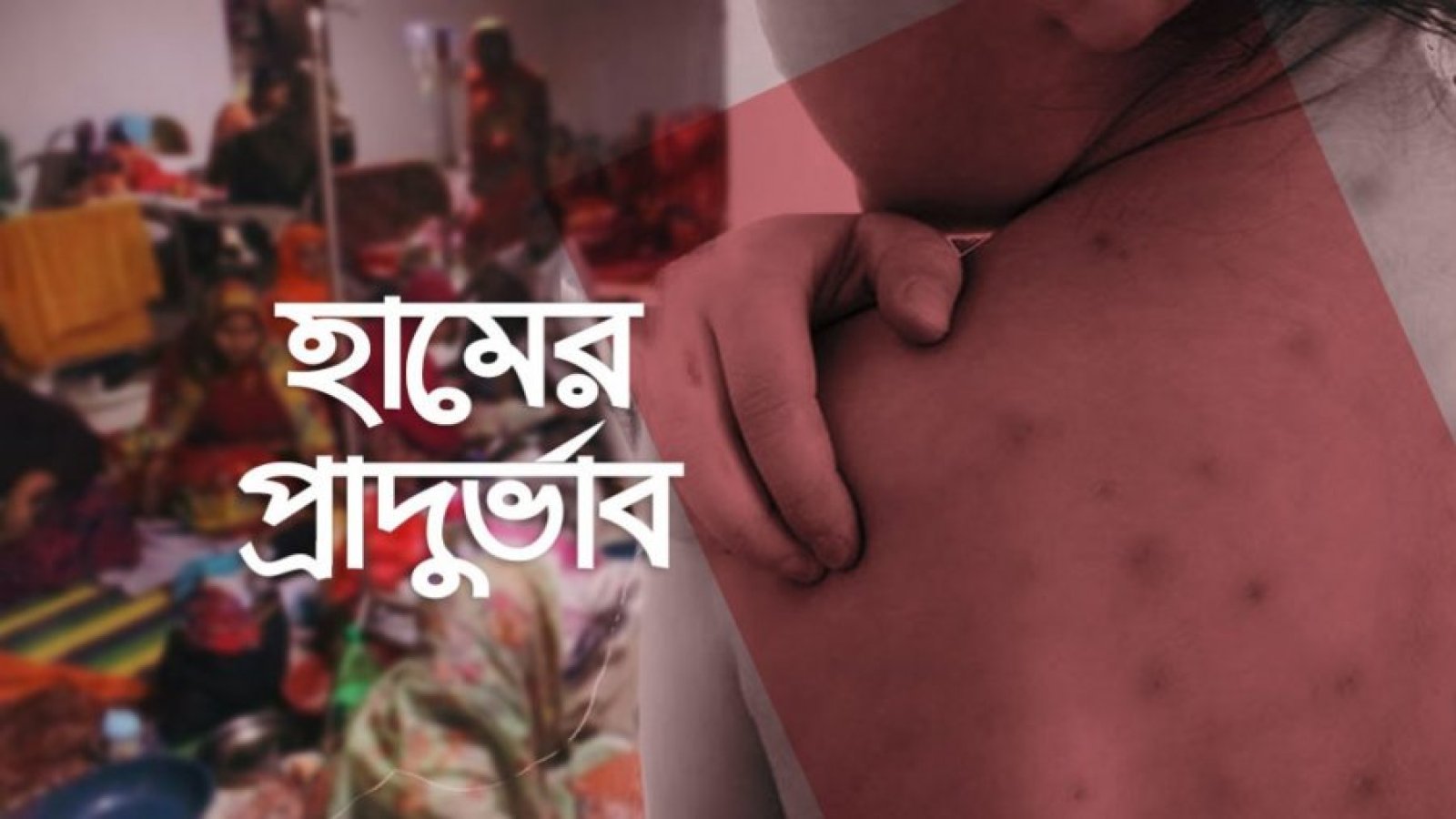 হামে ৩ শতাধিক মৃত্যু, তৃতীয় শতক ছাড়ালো ১৯ দিনে