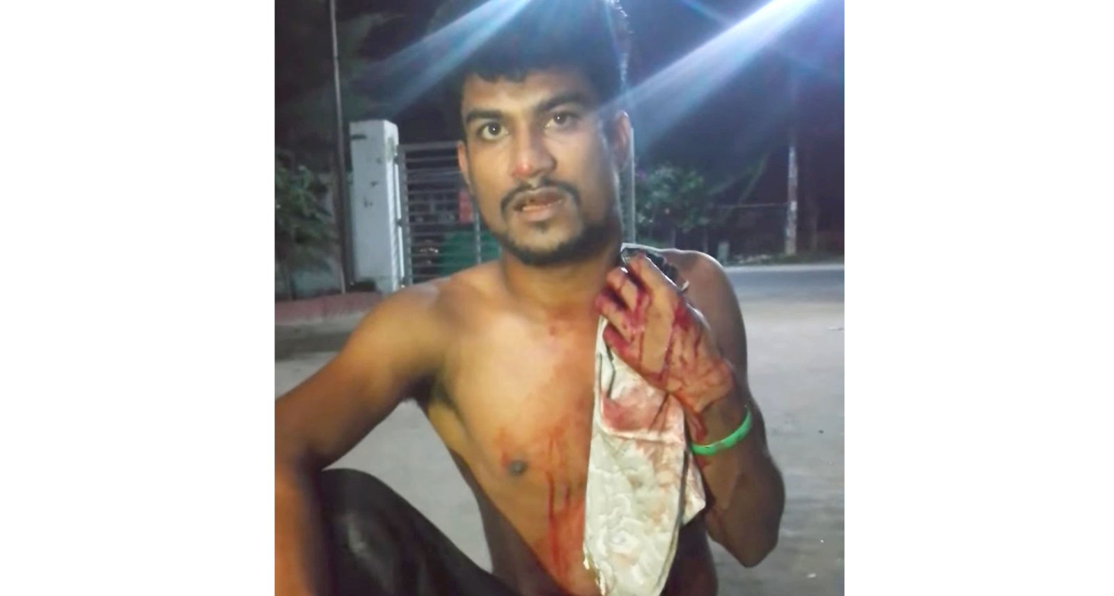 ঈশ্বরদীতে চালককে ছুরিকাঘাত করে অটোরিকশা ছিনতাই