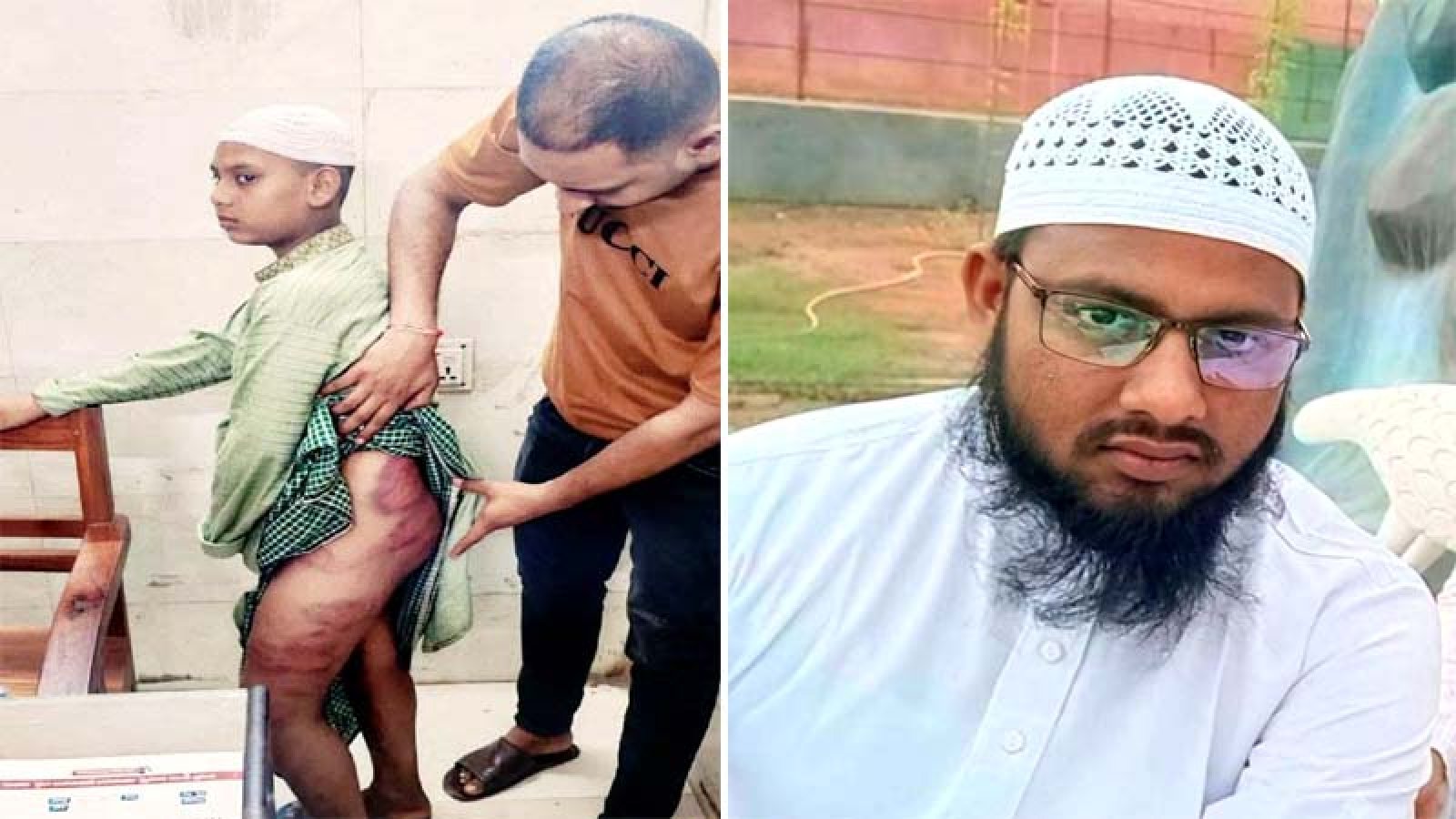 চুরির অপবাদে শিক্ষার্থীকে বেত-লোহার রড দিয়ে নির্মম নির্যাতন, গণধোলাইয়ের পর শিক্ষককে পুলিশে সোপর্দ