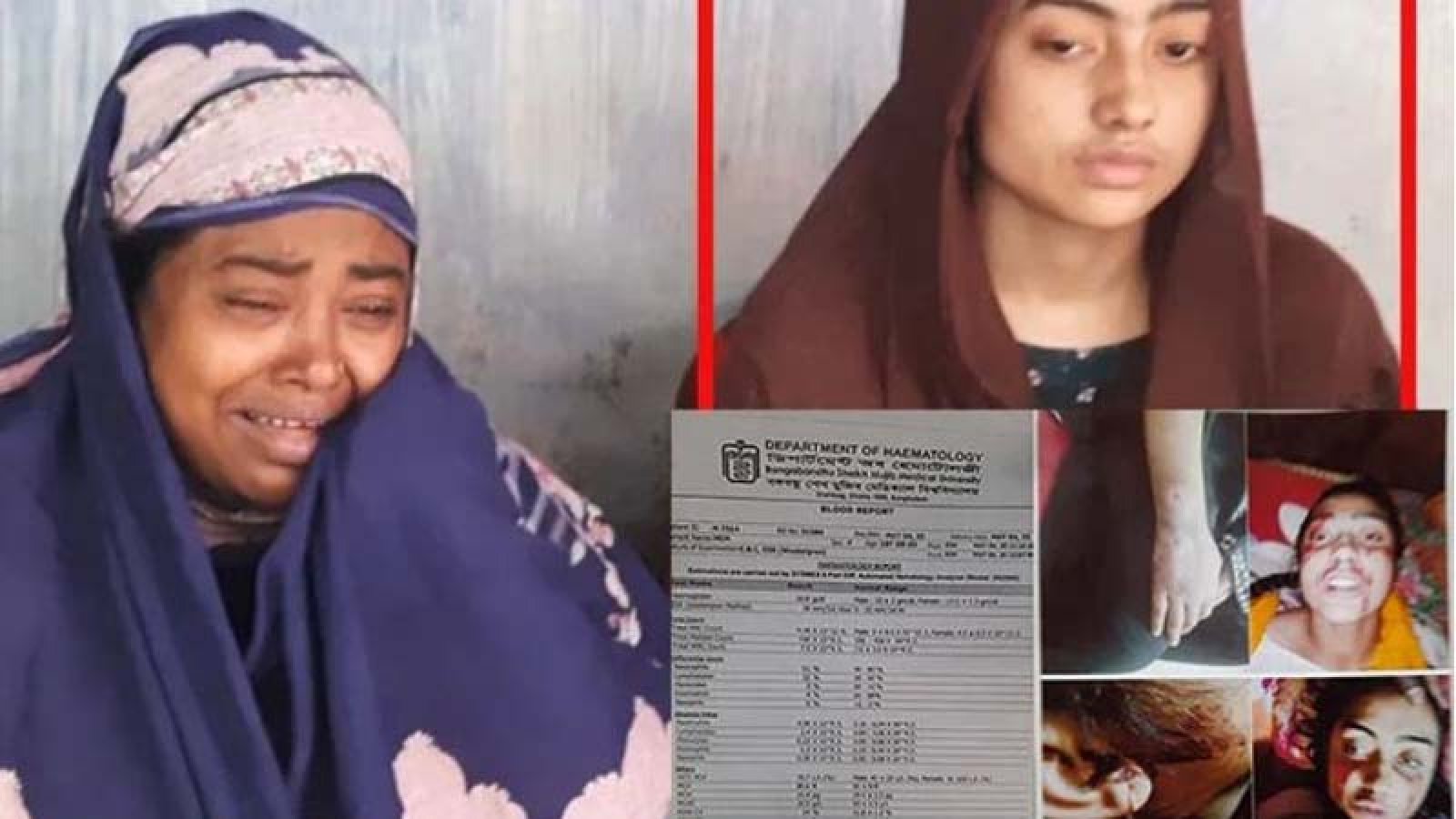 বিরল রোগে আক্রান্ত মিম, বাঁচার আশায় এফবিতে সাহায্য প্রার্থনা