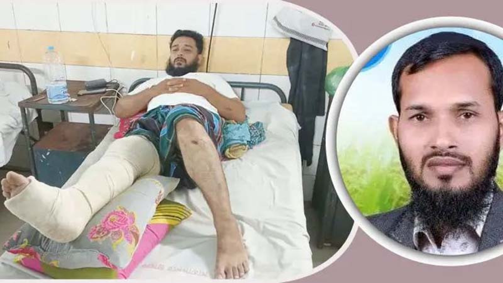 চাঁদা না দেওয়ায় ব্যবসায়ীর পা ভেঙে দিলেন যুবদল নেতা
