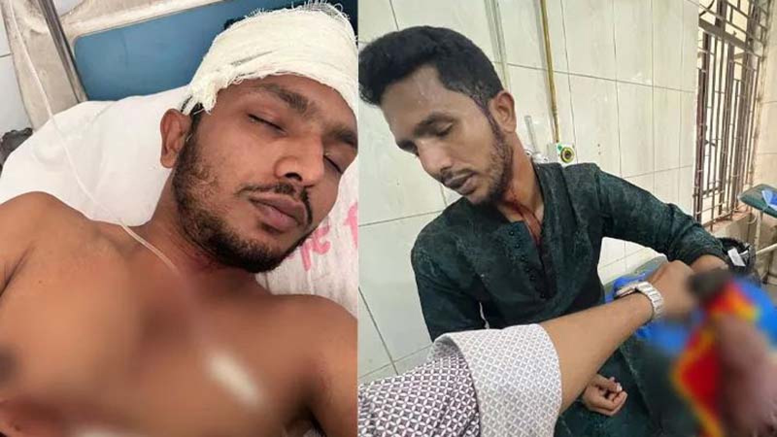 ছাত্রদল নেতার উপস্থিতে কর্মীর ‘রগ কর্তন’, আবির কি ছাত্রলীগের