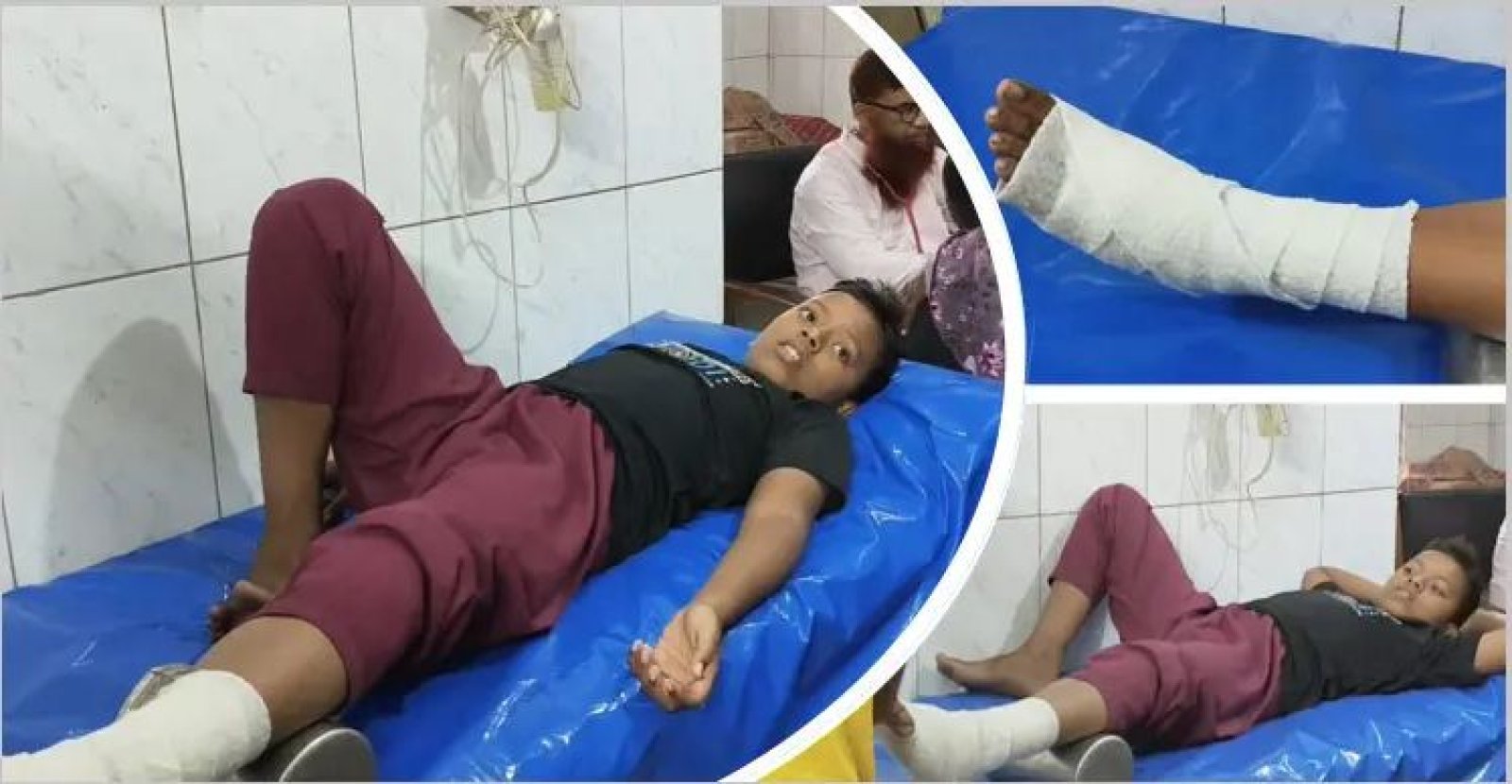 পড়া না পারায় পিটিয়ে মাদরাসাছাত্রের পা ভেঙে দিলেন শিক্ষক