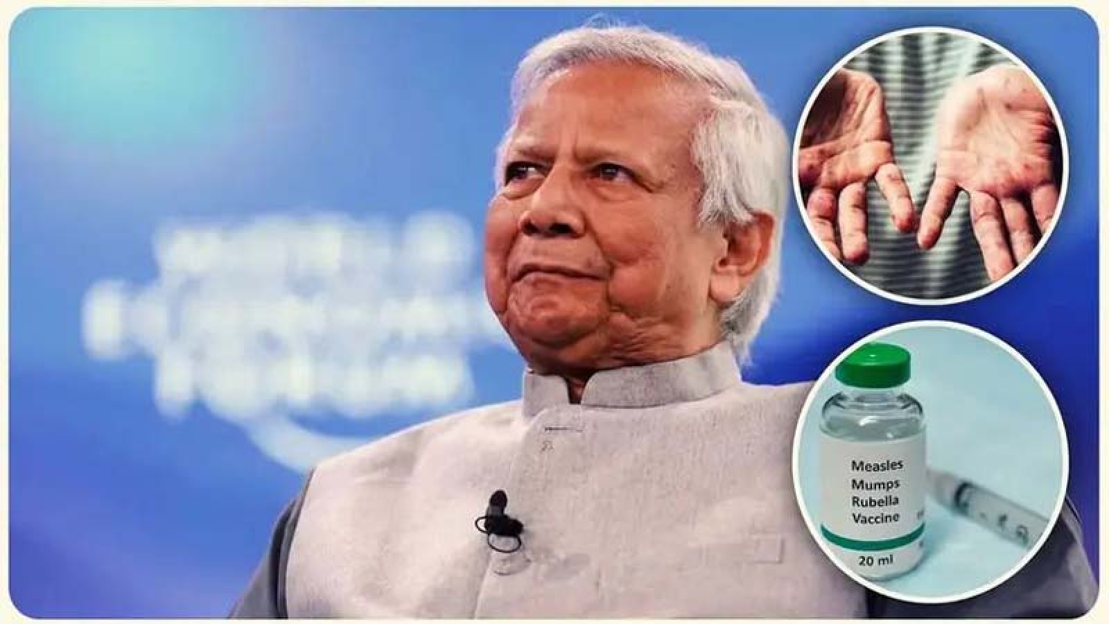ইউনূস সরকারের আমলেও ছিল টিকা, যে কারণে দেওয়া হয়নি