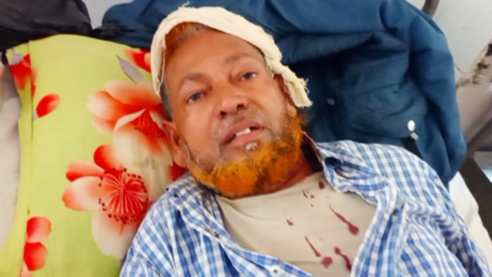 তানোরে সম্পত্তি নিয়ে বিরোধের জেরে চাচার মাথা ফাটালেন ভাতিজা