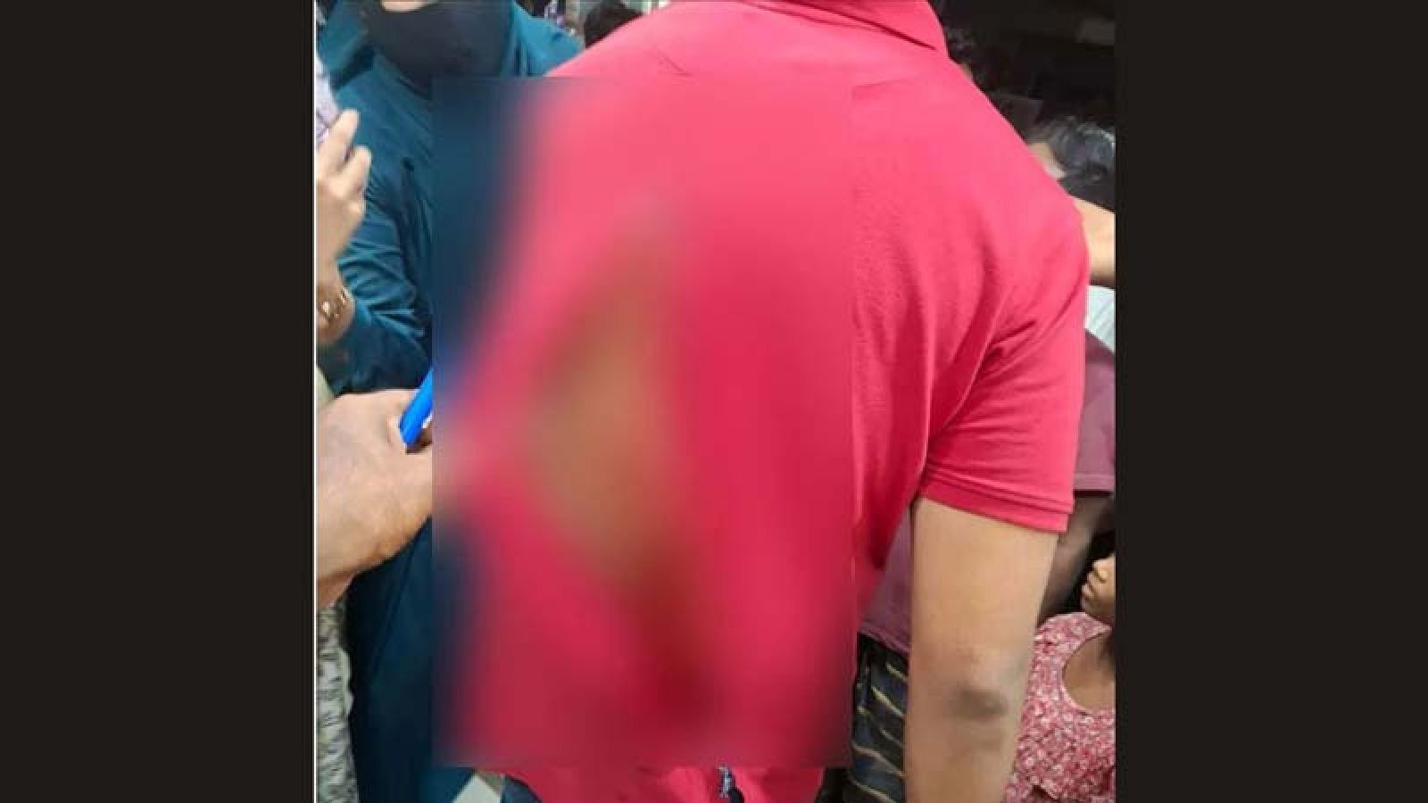 মোহাম্মদপুরে ইমিগ্রেশন পুলিশের এসআইকে কুপিয়ে জখম, পিঠে ৪৩ সেলাই