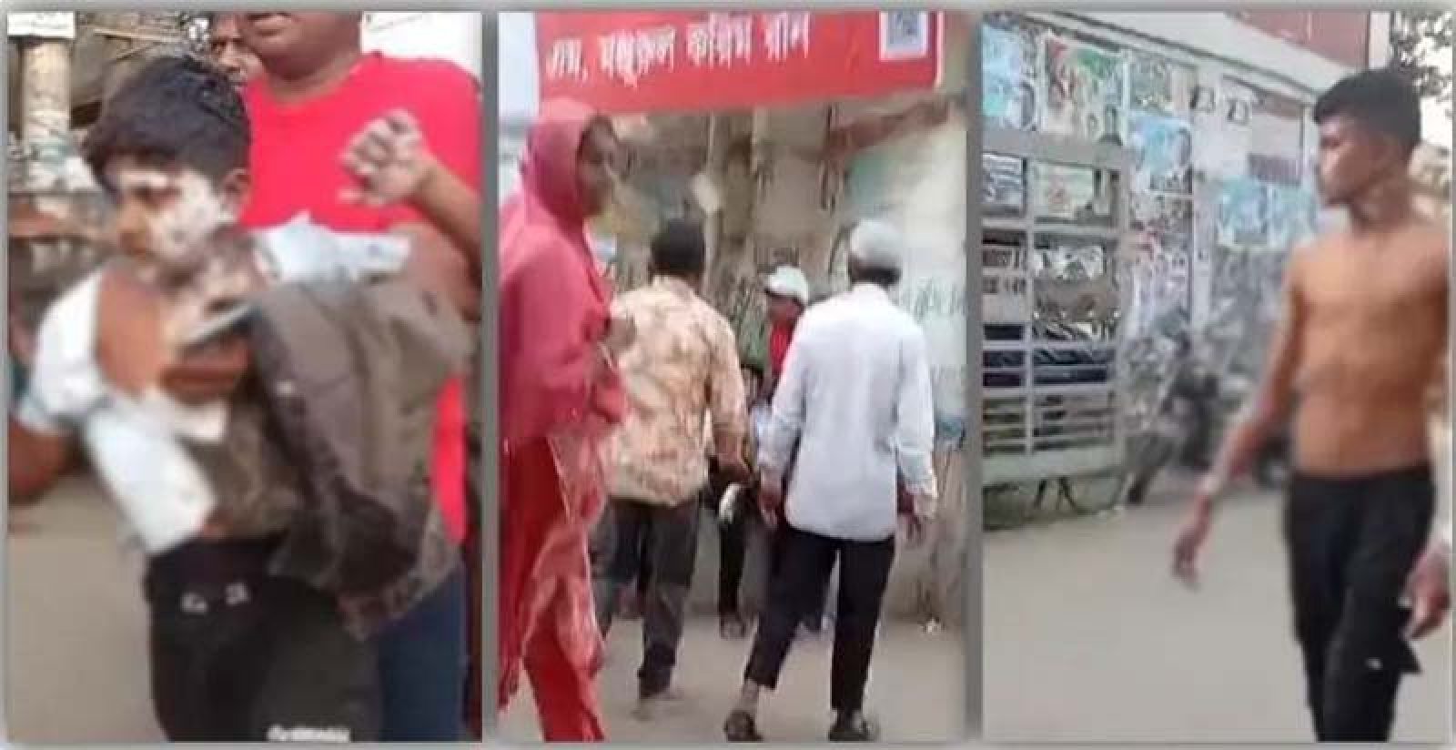 বিএনপির গণমিছিলের প্রস্তুতিকালে গ্যাস বেলুন বিস্ফোরণে অর্ধশতাধিক দগ্ধ