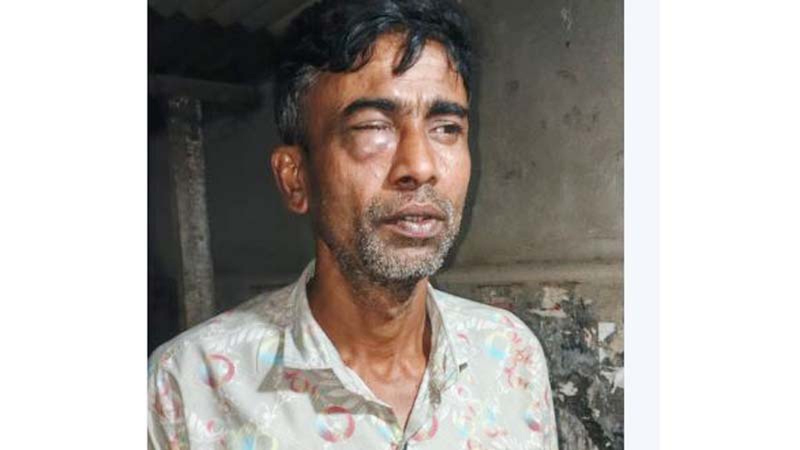 খাবার বিল বেশি না করায় হোটেল কর্মচারীকে পিটিয়ে জখম করলো মালিক