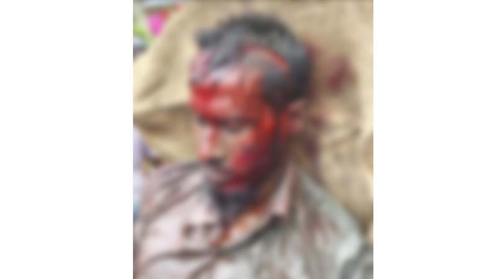 তানোরে হামলার ঘটনায় মামলা, আসামিরা এখনো ধরাছোঁয়ার বাইরে