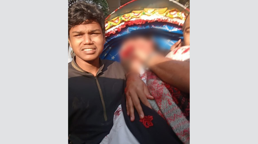 হাদি ছিলেন রিকশায়, মোটরসাইকেলে এসে দুর্বৃত্তরা গুলি করে