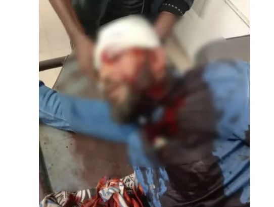 খুলনায় এনসিপি নেতাকে প্রকাশ্যে গুলি