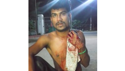 ঈশ্বরদীতে চালককে ছুরিকাঘাত করে অটোরিকশা ছিনতাই