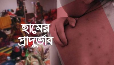 হাম সন্দেহে নিভে গেলো আরও ৮ শিশুর প্রাণ