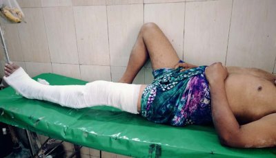 চাঁদা না পেয়ে ব্যবসায়ীকে তুলে নিয়ে হাত-পা ভেঙে দিলেন শ্রমিকদল নেতা