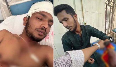 ছাত্রদল নেতার উপস্থিতে কর্মীর ‘রগ কর্তন’, আবির কি ছাত্রলীগের
