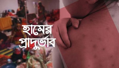 ইদের দিনে হাম কেড়ে নিলো আরও ৫ প্রাণ