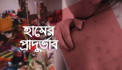 হাম উপসর্গে একদিনে আরও ৭ মৃত্যু