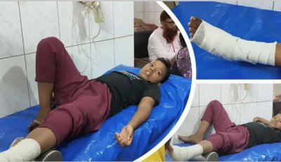 পড়া না পারায় পিটিয়ে মাদরাসাছাত্রের পা ভেঙে দিলেন শিক্ষক