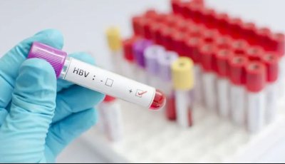 এক বছরে বিশ্বজুড়ে হেপাটাইটিস বি কমেছে ৩২ শতাংশ
