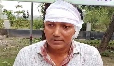 মান্দায় মাদকসেবীর হামলায় স্কুলশিক্ষক গুরুতর আহত