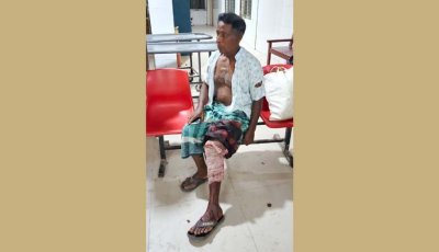 তানোরে বর্গাচাষীকে হাতুড়ি দিয়ে পিটিয়ে পাঁ ভেঙে দিলো প্রতিপক্ষ