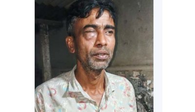 খাবার বিল বেশি না করায় হোটেল কর্মচারীকে পিটিয়ে জখম করলো মালিক