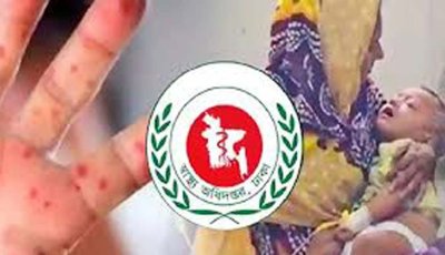 হাম ও উপসর্গে আরও ১২ মৃত্যু
