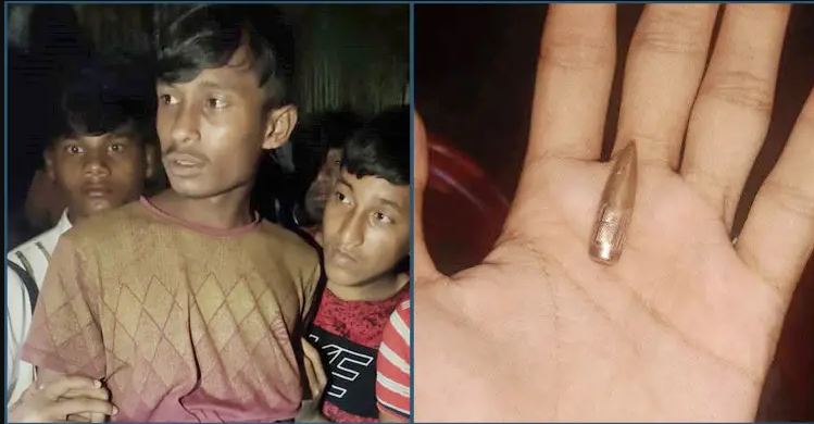 টেকনাফ : সীমান্তের ওপারে গোলাগুলি, এপারে গুলিবিদ্ধ রোহিঙ্গা যুবক