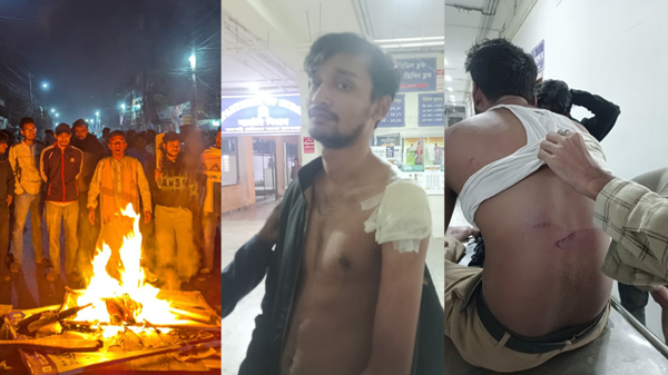দুর্বৃত্তদের হামলায় ৩ রাবি শিক্ষার্থী আহত, প্রতিবাদে মহাসড়ক অবরোধ